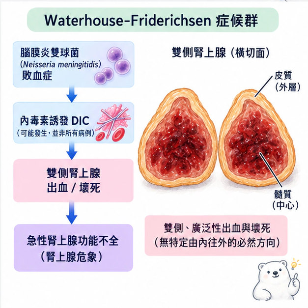 雙側腎上腺出血:Waterhouse-Friderichsen 症候群:學術水彩圖解,包含本節的主要結構與關係。